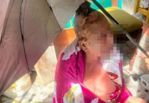 Adulta mayor y su mascota resultaron heridas tras explosión de una pipeta de gas en San Antonio de Prado