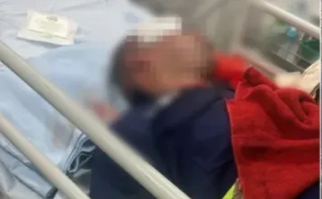 conductor con fracturas